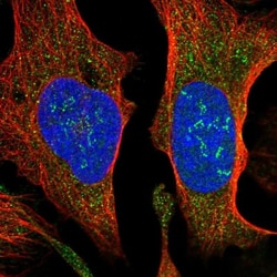 SUCO Antibody, Novus Biologicals 0.1mL; Unlabeled:Antibodies, Polyclonal